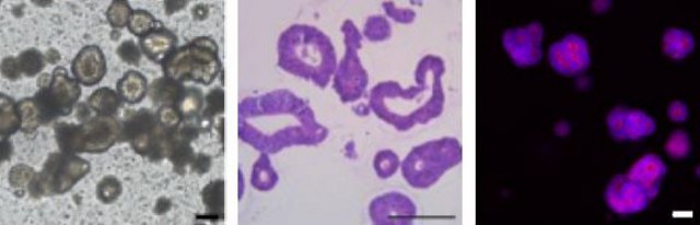 3dGRO&#174; Human CRC Organoids (ISO48)