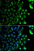 Anti-RAB5A antibody produced in rabbit