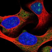Anti-RPL18A antibody produced in rabbit Prestige Antibodies&#174; Powered by Atlas Antibodies, affinity isolated antibody, buffered aqueous glycerol solution