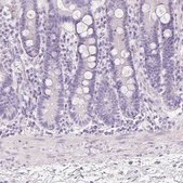 Anti-MUC5AC antibody produced in rabbit Prestige Antibodies&#174; Powered by Atlas Antibodies, affinity isolated antibody, buffered aqueous glycerol solution