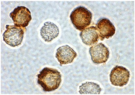 Anti-IRAK-2 Antibody from rabbit, purified by affinity chromatography