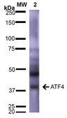 Monoclonal Anti-Pink1 antibody produced in mouse clone S4-15, purified immunoglobulin