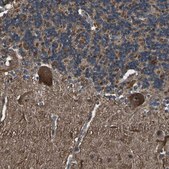 Anti-DHPS antibody produced in rabbit Prestige Antibodies&#174; Powered by Atlas Antibodies, affinity isolated antibody, buffered aqueous glycerol solution