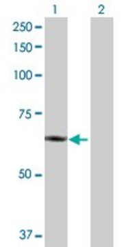 Anti-PLTP antibody produced in rabbit purified immunoglobulin, buffered aqueous solution