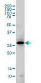 Monoclonal Anti-GCH1 antibody produced in mouse clone 4A12, purified immunoglobulin, buffered aqueous solution