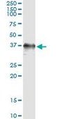 Monoclonal Anti-RAD51 antibody produced in mouse clone 4C11-B4, purified immunoglobulin, buffered aqueous solution