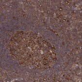 Anti-CAD antibody produced in rabbit Prestige Antibodies&#174; Powered by Atlas Antibodies, affinity isolated antibody