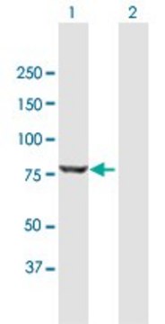 Anti-DKFZP434G1415 antibody produced in mouse purified immunoglobulin, buffered aqueous solution