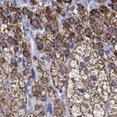 Anti-MGARP antibody produced in rabbit Prestige Antibodies&#174; Powered by Atlas Antibodies, affinity isolated antibody, buffered aqueous glycerol solution