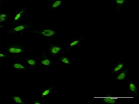 ANTI-LHX6 antibody produced in mouse clone 1B11, purified immunoglobulin, buffered aqueous solution