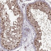 Anti-NR2C1 antibody produced in rabbit Prestige Antibodies&#174; Powered by Atlas Antibodies, affinity isolated antibody