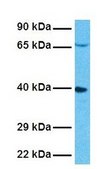Anti-OTC antibody produced in rabbit IgG fraction of antiserum