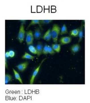 Anti-LDHB affinity isolated antibody