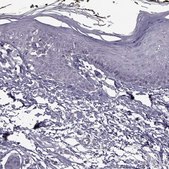 Anti-SYNPO2 antibody produced in rabbit Prestige Antibodies&#174; Powered by Atlas Antibodies, affinity isolated antibody
