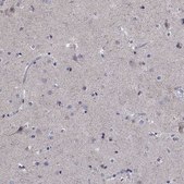 Anti-SDC1 antibody produced in rabbit Prestige Antibodies&#174; Powered by Atlas Antibodies, affinity isolated antibody, buffered aqueous glycerol solution