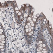 Monoclonal Anti-LAMA3 antibody produced in mouse Prestige Antibodies&#174; Powered by Atlas Antibodies, clone CL3112, purified immunoglobulin, buffered aqueous glycerol solution