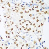 Anti-HDAC1 antibody produced in rabbit