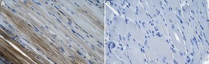Anti-Hexokinase-2 Antibody, clone 1F3 ZooMAb&#174; Rabbit Monoclonal recombinant, expressed in HEK 293 cells