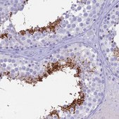 Anti-ACE antibody produced in rabbit Prestige Antibodies&#174; Powered by Atlas Antibodies, affinity isolated antibody, buffered aqueous glycerol solution
