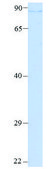 Anti-FURIN (N-terminal) antibody produced in rabbit affinity isolated antibody