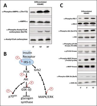 Human Skeletal Muscle Cells: HSkMC: Pre-Screened for Insulin &amp; AMPK signaling, adult