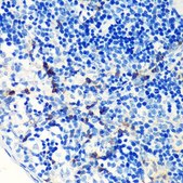 Anti-FSP1/S100A4 antibody produced in rabbit