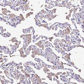 Anti-NME5 antibody produced in rabbit affinity isolated antibody, buffered aqueous glycerol solution