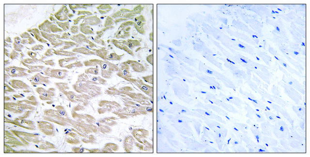 Anti-RAD antibody produced in rabbit affinity isolated antibody