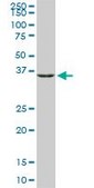 Monoclonal Anti-GLUL, (C-terminal) antibody produced in mouse clone 3B6, purified immunoglobulin, buffered aqueous solution