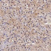 Anti-CHRDL1 antibody produced in rabbit Ab1, Prestige Antibodies&#174; Powered by Atlas Antibodies, affinity isolated antibody, buffered aqueous glycerol solution