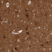 Anti-VPS53 antibody produced in rabbit affinity isolated antibody, buffered aqueous glycerol solution
