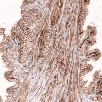 Monoclonal Anti-ROR2 antibody produced in mouse Prestige Antibodies&#174; Powered by Atlas Antibodies, clone CL5950, purified immunoglobulin, buffered aqueous glycerol solution