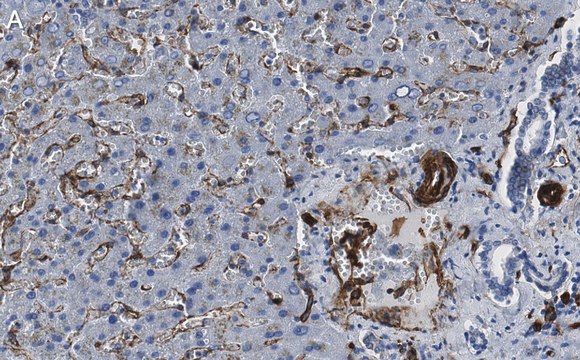 Anti-Caveolin-1 Antibody, clone 1D10 ZooMAb&#174; Rabbit Monoclonal recombinant, expressed in HEK 293 cells