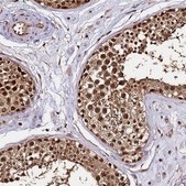 Anti-PPP4C antibody produced in rabbit Prestige Antibodies&#174; Powered by Atlas Antibodies, affinity isolated antibody, buffered aqueous glycerol solution