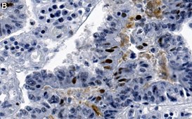 Anti-phospho-Chk2-Thr68 Antibody, clone 1B17 ZooMAb&#174; Rabbit Monoclonal recombinant, expressed in HEK 293 cells