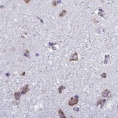 Anti-RPS15 antibody produced in rabbit Prestige Antibodies&#174; Powered by Atlas Antibodies, affinity isolated antibody, buffered aqueous glycerol solution