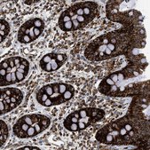 Anti-SQRDL antibody produced in rabbit Prestige Antibodies&#174; Powered by Atlas Antibodies, affinity isolated antibody, buffered aqueous glycerol solution