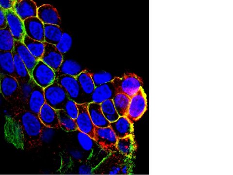 Anti-phospho-EGFR (Tyr1069) Antibody from rabbit, purified by affinity chromatography