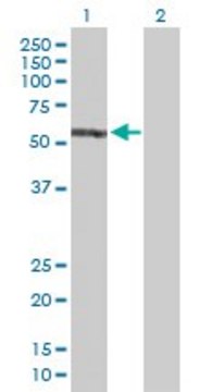 Anti-EPB41 antibody produced in rabbit purified immunoglobulin, buffered aqueous solution