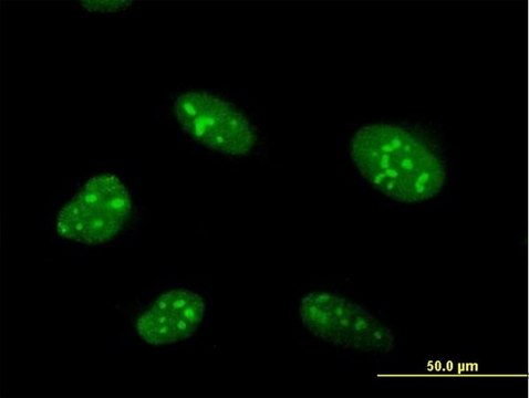 Anti-ZNF593 antibody produced in mouse purified immunoglobulin, buffered aqueous solution