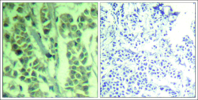 Anti-phospho-CBL (pTyr700) antibody produced in rabbit affinity isolated antibody