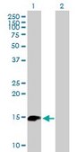 Anti-BIRC5 antibody produced in mouse purified immunoglobulin, buffered aqueous solution