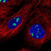 Anti-DDX18 antibody produced in rabbit Prestige Antibodies&#174; Powered by Atlas Antibodies, affinity isolated antibody