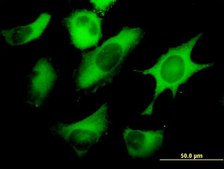 Monoclonal Anti-FASN antibody produced in mouse clone 3F2-1F3, purified immunoglobulin, buffered aqueous solution
