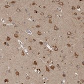 Anti-ATXN2 antibody produced in rabbit Prestige Antibodies&#174; Powered by Atlas Antibodies, affinity isolated antibody, buffered aqueous glycerol solution, Ab2