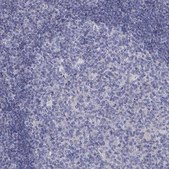 Anti-EPDR1 antibody produced in rabbit Prestige Antibodies&#174; Powered by Atlas Antibodies, affinity isolated antibody, buffered aqueous glycerol solution