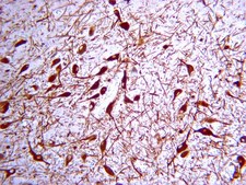 Anti-Tyrosine Hydroxylase Antibody Chemicon&#174;, from rabbit
