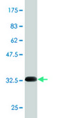 Monoclonal Anti-SCN9A antibody produced in mouse clone 5A11, purified immunoglobulin, buffered aqueous solution