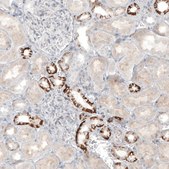 Anti-L1CAM antibody produced in rabbit Prestige Antibodies&#174; Powered by Atlas Antibodies, affinity isolated antibody, buffered aqueous glycerol solution