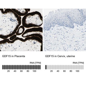 Anti-GDF15 antibody produced in rabbit Prestige Antibodies&#174; Powered by Atlas Antibodies, affinity isolated antibody, buffered aqueous glycerol solution